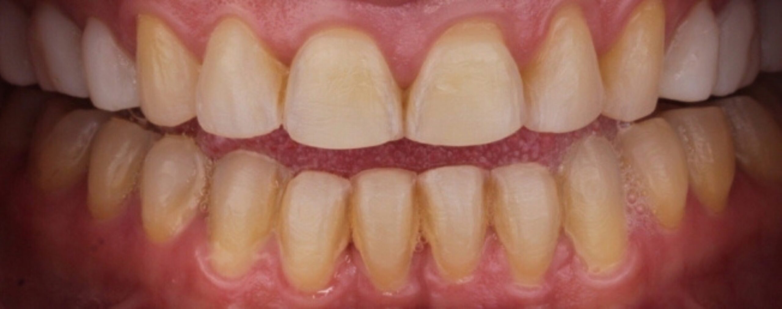 After image