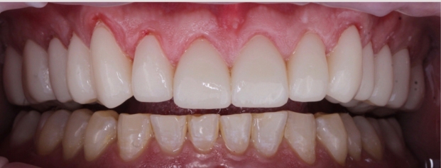 After image
