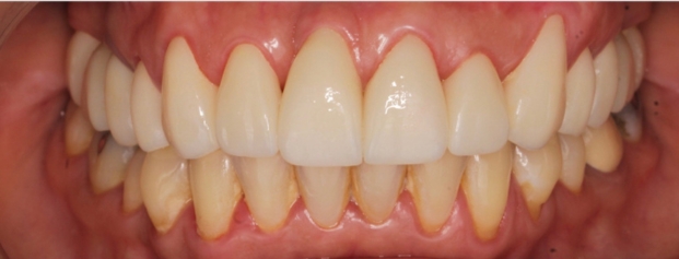 Before image
