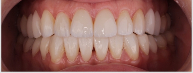 Before image