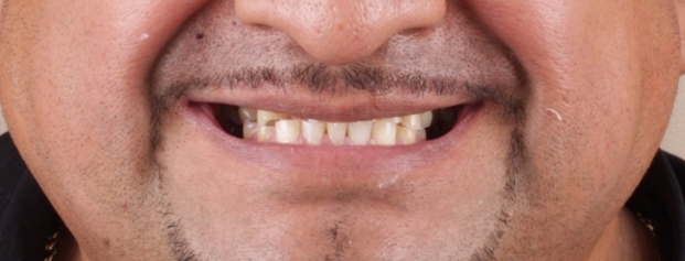 After image