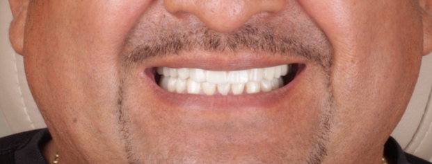 Before image